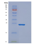 人密度调节蛋白(DENR)重组蛋白