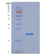 人亲环素A(Cyclophilin A)重组蛋白