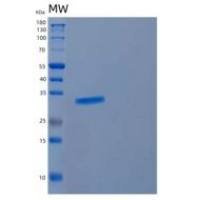 人CYB5R2重组蛋白