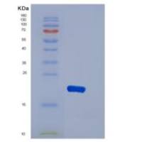 人DBNDD2重组蛋白