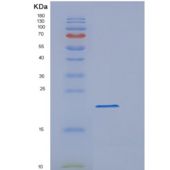 人肽基脯氨酰异构酶F(PPIF)重组蛋白