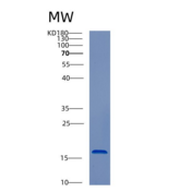 人半胱氨酸蛋白酶抑制剂1(CST1)重组蛋白