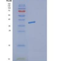 小鼠Decorin重组蛋白