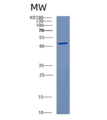 人CSNK2A2重组蛋白
