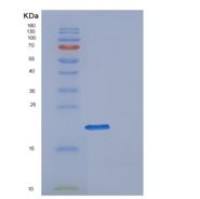 人DESI1重组蛋白