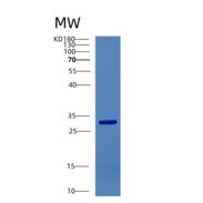 人CTDSP1重组蛋白