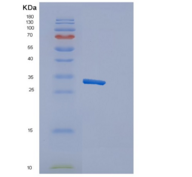 人细胞毒性和调节性T细胞分子蛋白质重组蛋白