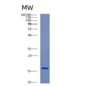 人半胱氨酸蛋白酶抑制剂1(CST1)重组蛋白