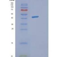 人脱氧辅蛋白合酶(DHPS)重组蛋白