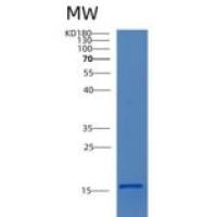 人细胞毒性T-淋巴细胞关联抗原4(CTLA4)重组蛋白