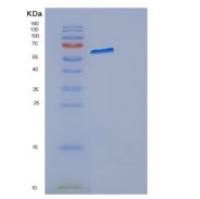 人天冬氨酰tRNA合成酶(DARS)重组蛋白