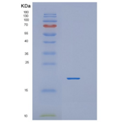 人亲环素H（PPIH）重组蛋白