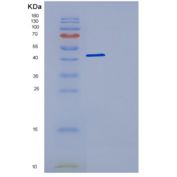 人动力蛋白激活蛋白2(DCTN2)重组蛋白