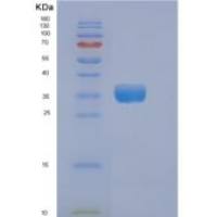 人Dickkopf相关蛋白3(DKK3)重组蛋白