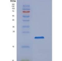 人亲环素B（Cyclophilin B）重组蛋白
