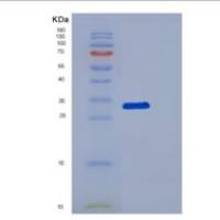 人DCAF7重组蛋白