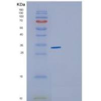 人CYB5R1重组蛋白