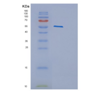 人细胞色素P450家族成员2E1(CYP2E1)重组蛋白