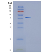 人动力蛋白激活蛋白2(DCTN2)重组蛋白