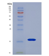 人B-淋巴细胞趋化因子(BLC)重组蛋白