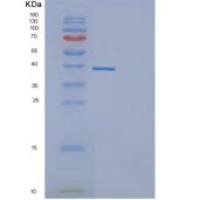 人DEDD重组蛋白