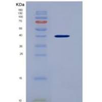 人趋化因子 (C-X-C基序)配体1(CXCL1)重组蛋白