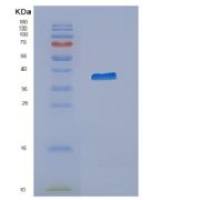 人Cytohesin-3 (CYTH3)重组蛋白