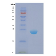 人DIRAS1重组蛋白