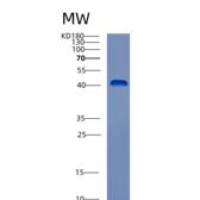人酪蛋白激酶1α1(CSNK1a1)重组蛋白