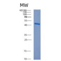 人组织蛋白酶W(CTSW)重组蛋白