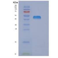 人二氢硫辛酸脱氢酶(DLD)重组蛋白