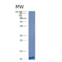人连环蛋白β相互作用蛋白1(CTNNbIP1)重组蛋白