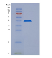 人细胞周期蛋白H(Cyclin H)重组蛋白