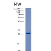 人酪蛋白β(CSN2)重组蛋白