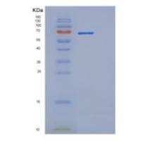 人多巴胺β羟化酶(DbH)重组蛋白