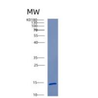 大鼠Cst3重组蛋白