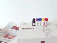 人抗酒石酸酸性磷酸酶5b(TRACP-5b)ELISA试剂盒