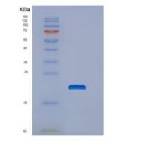 人DNAJC24重组蛋白