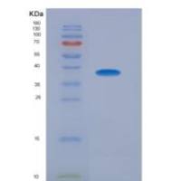 人胚外胚层发育蛋白(EED)重组蛋白