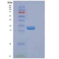 小鼠Eif4e重组蛋白