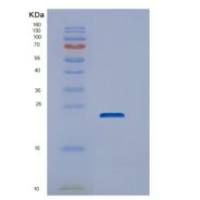 人DUSP22重组蛋白