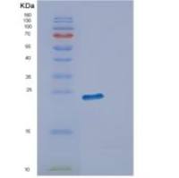 人ECSIT重组蛋白