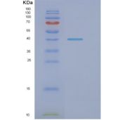 大肠杆菌Dnak（N端；1-384)重组蛋白