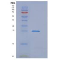 大肠杆菌DsbG重组蛋白