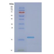 大肠杆菌DNA(385-546)重组蛋白