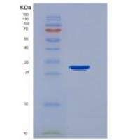人真核翻译延伸因子1δ(EEF1d)重组蛋白