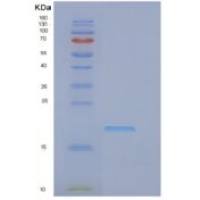 人真核翻译起始因子1A，Y染色体（EIF1AY）重组蛋白