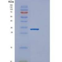 人酯酶D(ESD)重组蛋白