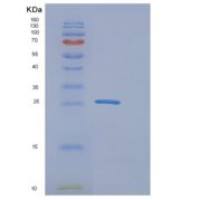 人红细胞生成素受体(EPOR)重组蛋白