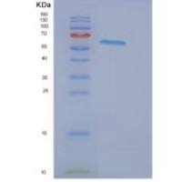 人肝配蛋白B受体2(EPHB2)重组蛋白
